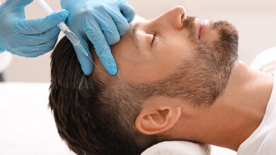 مزوتراپی مو در اصفهان؛🌱 بهترین راهحل است؟ (+هزینه 1405) مزوتراپی مو در اصفهان (بهترین برندها) + قیمت جلسات