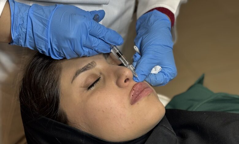 تزریق ژل لب در اصفهان (+قیمت 1404) و نمونه کار تزریق ژل لب در اصفهان