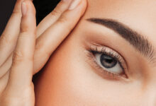 بوتاکس چشم گربه ای در اصفهان