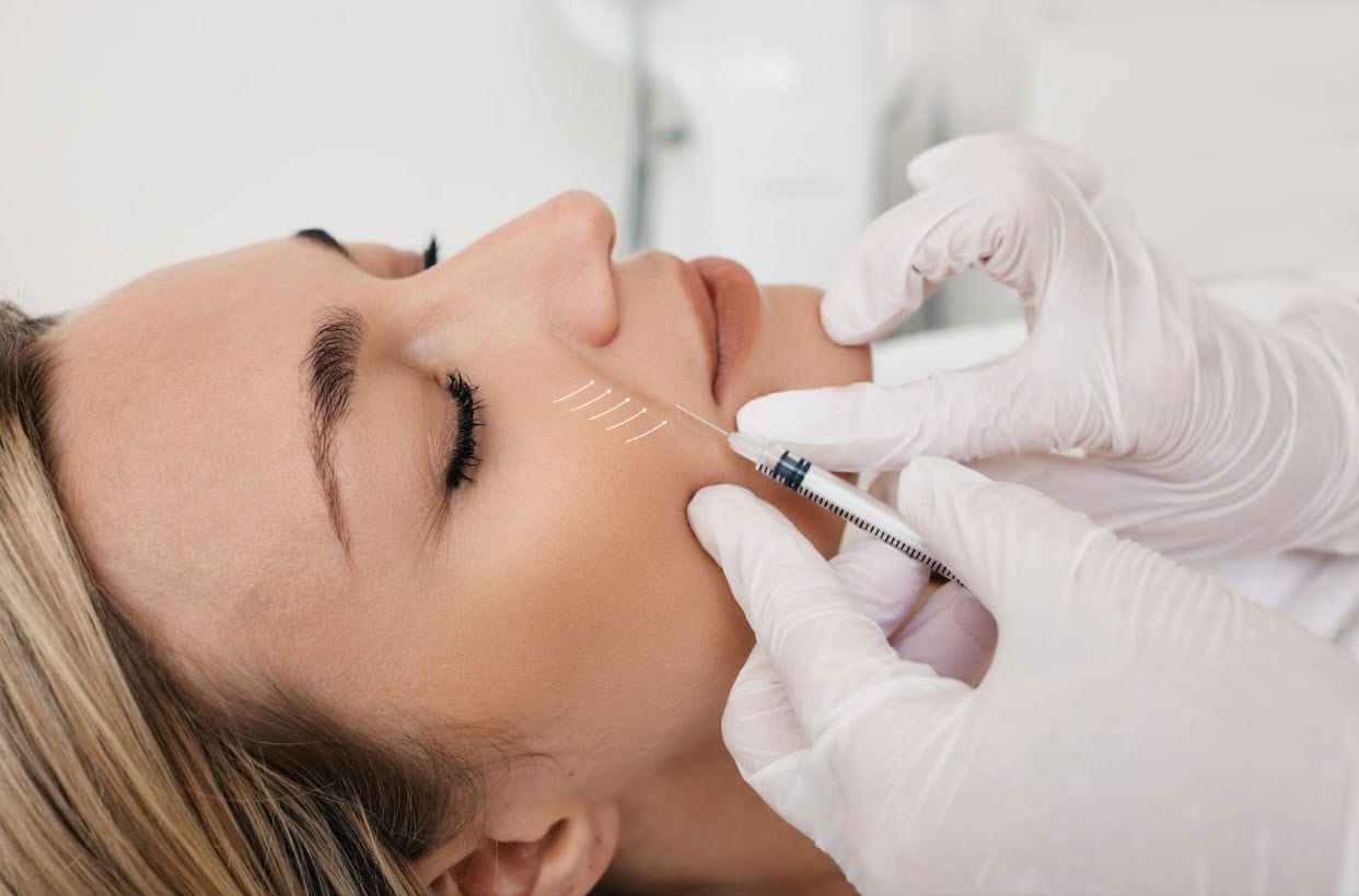 تزریق فیلر خط خنده در اصفهان😀 ؛ مزایا، مراحل و قیمت 1405 تزریق ژل خط خنده در اصفهان