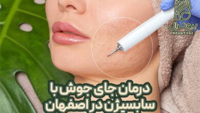 سابسیژن در اصفهان؛ درمان نهایی جای جوش و اسکار🎯 +هزینه 1405 درمان جای جوش با سابسیژن در اصفهان