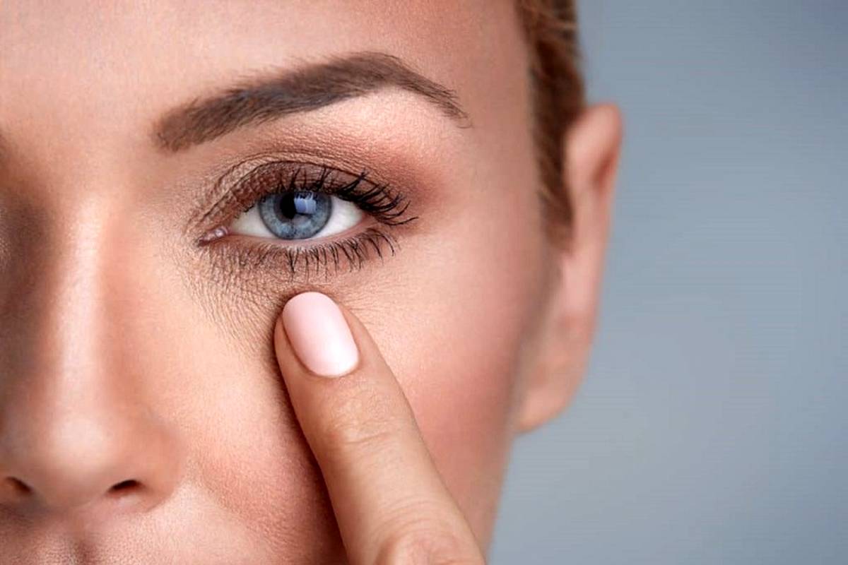 اندولیفت زیر چشم در اصفهان؛ قیمت ۱۴۰۵، پف و کاندید مناسب