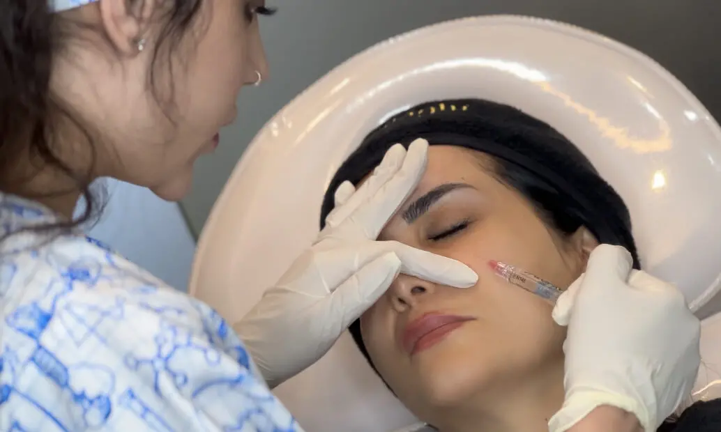 فیلر زیر چشم در اصفهان برای اصلاح گودی خط اشکی