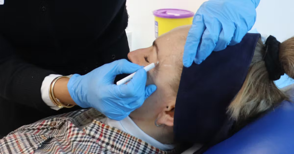 بوتاکس خطوط پنجه کلاغی اصفهان