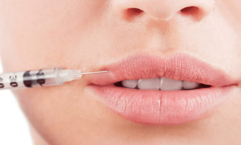 تزریق ژل لب طبیعی در اصفهان (+قیمت 1404) تزریق ژل لب طبیعی در اصفهان