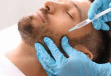 مزوتراپی ریش در اصفهان