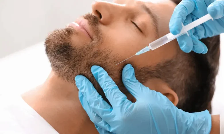 مزوتراپی ریش در اصفهان