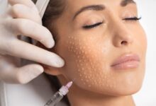 مزوتراپی صورت در اصفهان