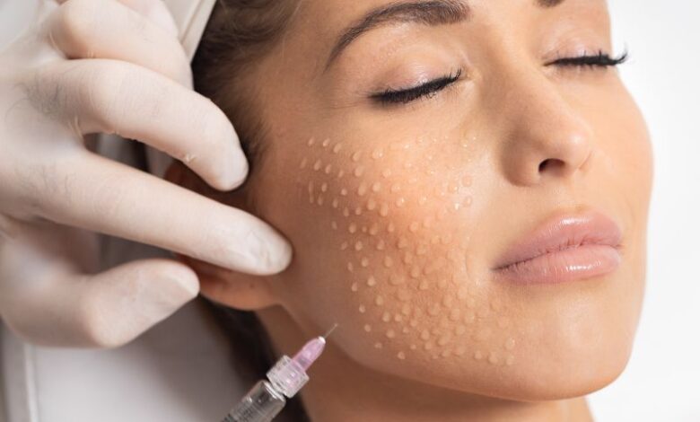 مزوتراپی صورت در اصفهان؛ فواید، عوارض و قیمت 1404 مزوتراپی صورت در اصفهان