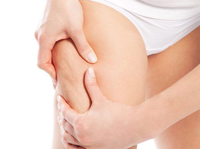 عوارض مزوتراپی لاغری در اصفهان