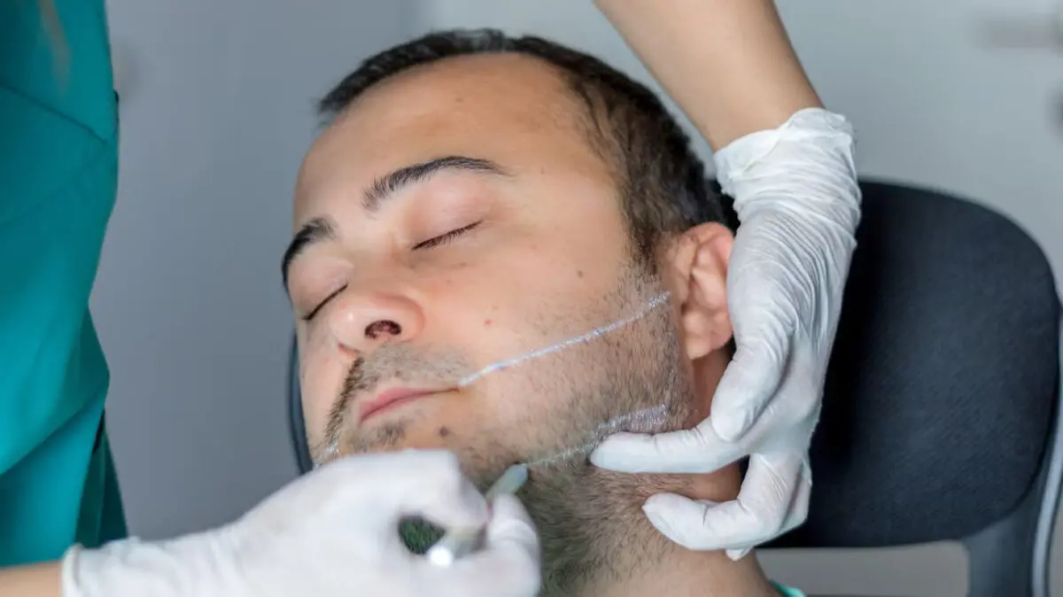تزریق فیلر زاویه فک در اصفهان🗿 (1405) جوانی چهره با مادلینگ💎 تزریق فیلر زاویه فک در اصفهان