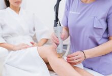 لیزر موهای زائد در اصفهان