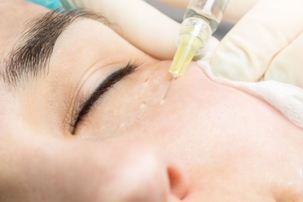 عوارض مزوتراپی در اصفهان