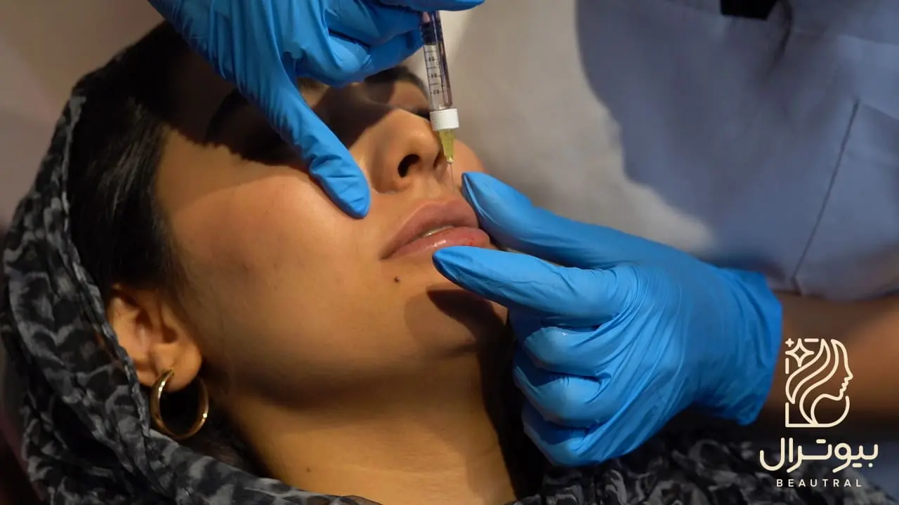 هزینه تزریق ژل لب در اصفهان در کلینیک بیوترال