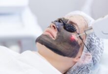 پیلینگ کربن در اصفهان در کلینیک بیوترال