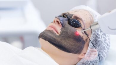 پیلینگ کربن در اصفهان در کلینیک بیوترال