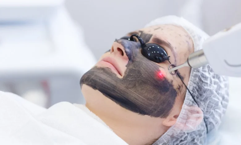 پیلینگ کربن در اصفهان در کلینیک بیوترال