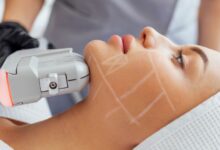 بهترین مرکز هایفوتراپی در اصفهان