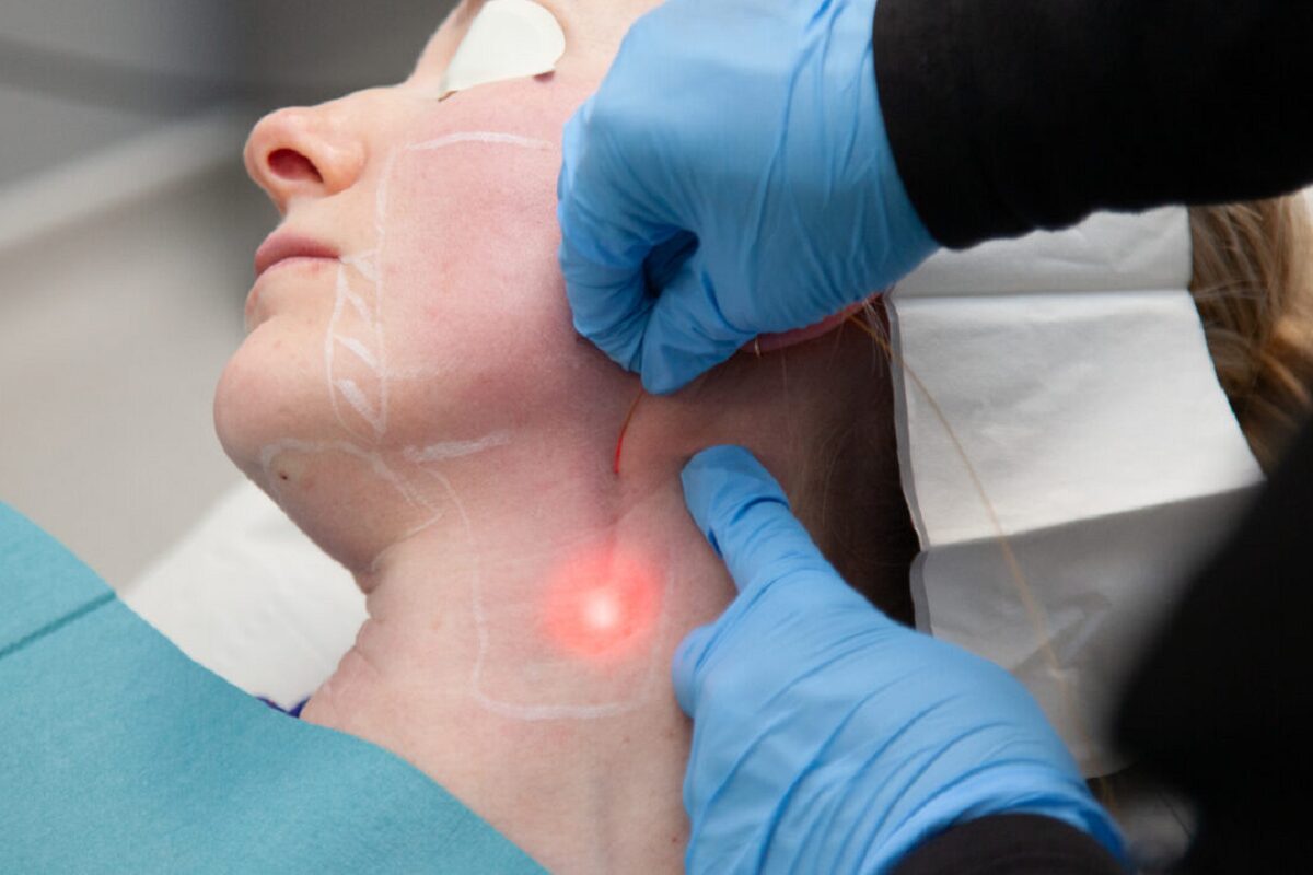 اندولیفت در اصفهان؛💖 مقایسه، مراحل و ماندگاری (+هزینه 1404) بهترین مرکز اندولیفت در اصفهان و هزینه انجام آن