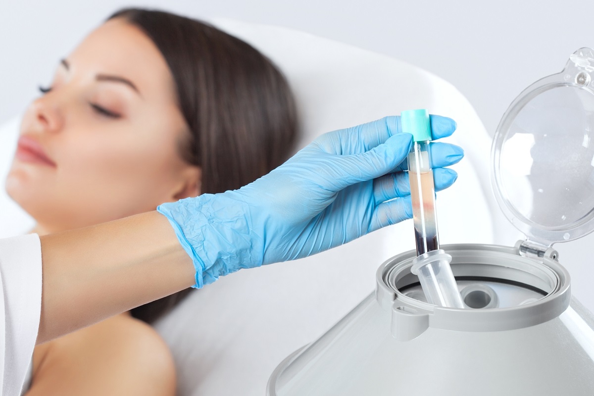مراحل تزریق PRP در اصفهان