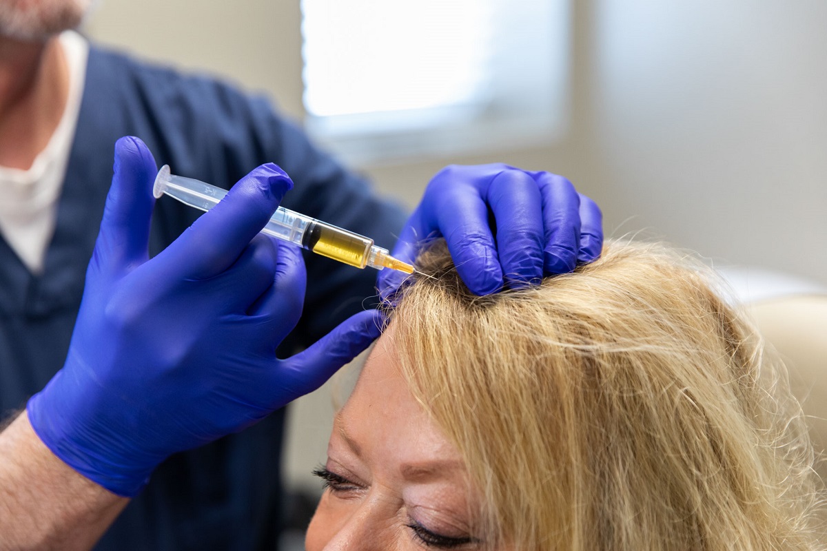 پی آر پی مو برای ریزش مو راهی برای کنترل ریزش مو و رشد مجدد آن