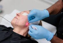 بهترین مرکز اندولیفت در اصفهان و راهنمای جامع انجام آن