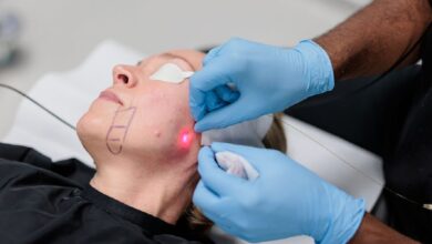 اندولیفت در اصفهان؛💖 مقایسه، مراحل و ماندگاری (+هزینه 1405) بهترین مرکز اندولیفت در اصفهان و راهنمای جامع انجام آن