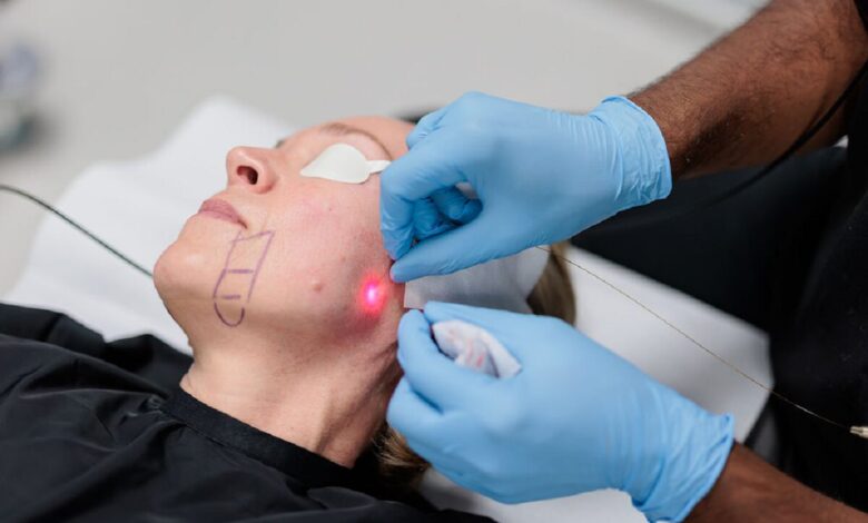 اندولیفت در اصفهان؛💖 مقایسه، مراحل و ماندگاری (+هزینه 1404) بهترین مرکز اندولیفت در اصفهان و راهنمای جامع انجام آن