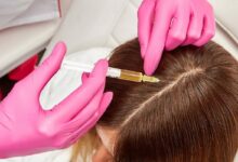 صفر تا صد پی آر پی مو در اصفهان از هزینه تا اثربخشی آن