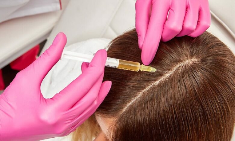 صفر تا صد پی آر پی مو در اصفهان از هزینه تا اثربخشی آن