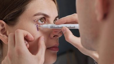 راهنمای جامع انتخاب بهترین دکتر بلفاروپلاستی در اصفهان و هزینه انجام آن